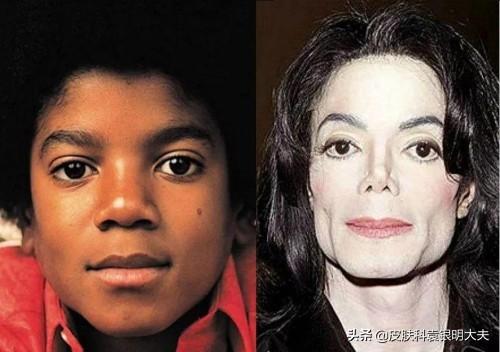迈克尔杰克逊是怎么变白的(迈克尔杰克逊是怎么变白的-)