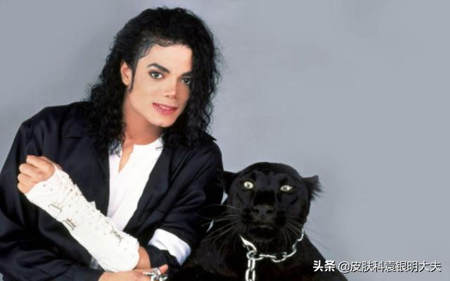 迈克尔杰克逊是怎么变白的(迈克尔杰克逊是怎么变白的-)